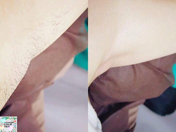 【睫毛娃娃】台中南屯熱蠟除毛推薦,義大利頂級護膚品牌RICA不咬肌吸附力